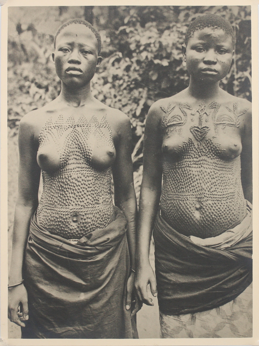 Unknown photographer (French). Female scarification. B/W photograph. 1920/1950.